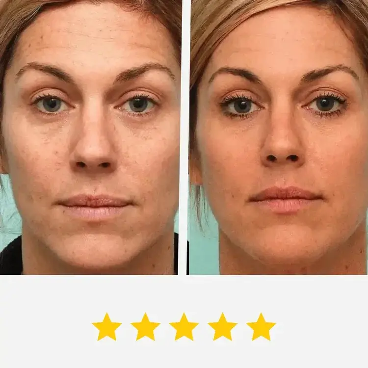 Before and after using Gelagen