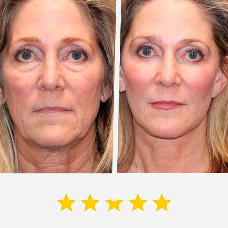 Before and after using Gelagen