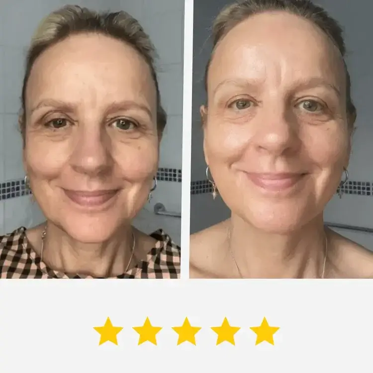 Before and after using Gelagen