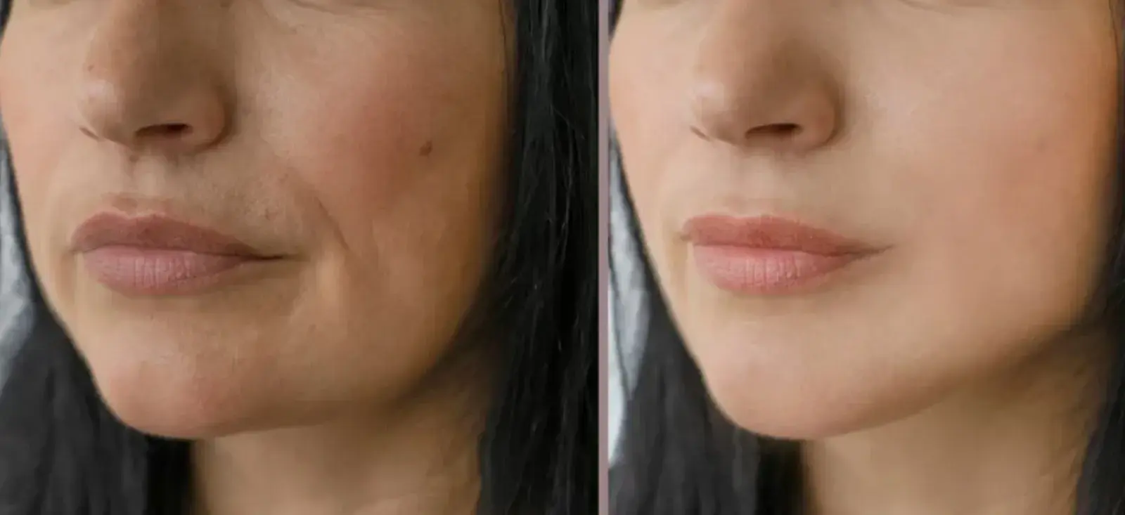 Before and after using Gelagen